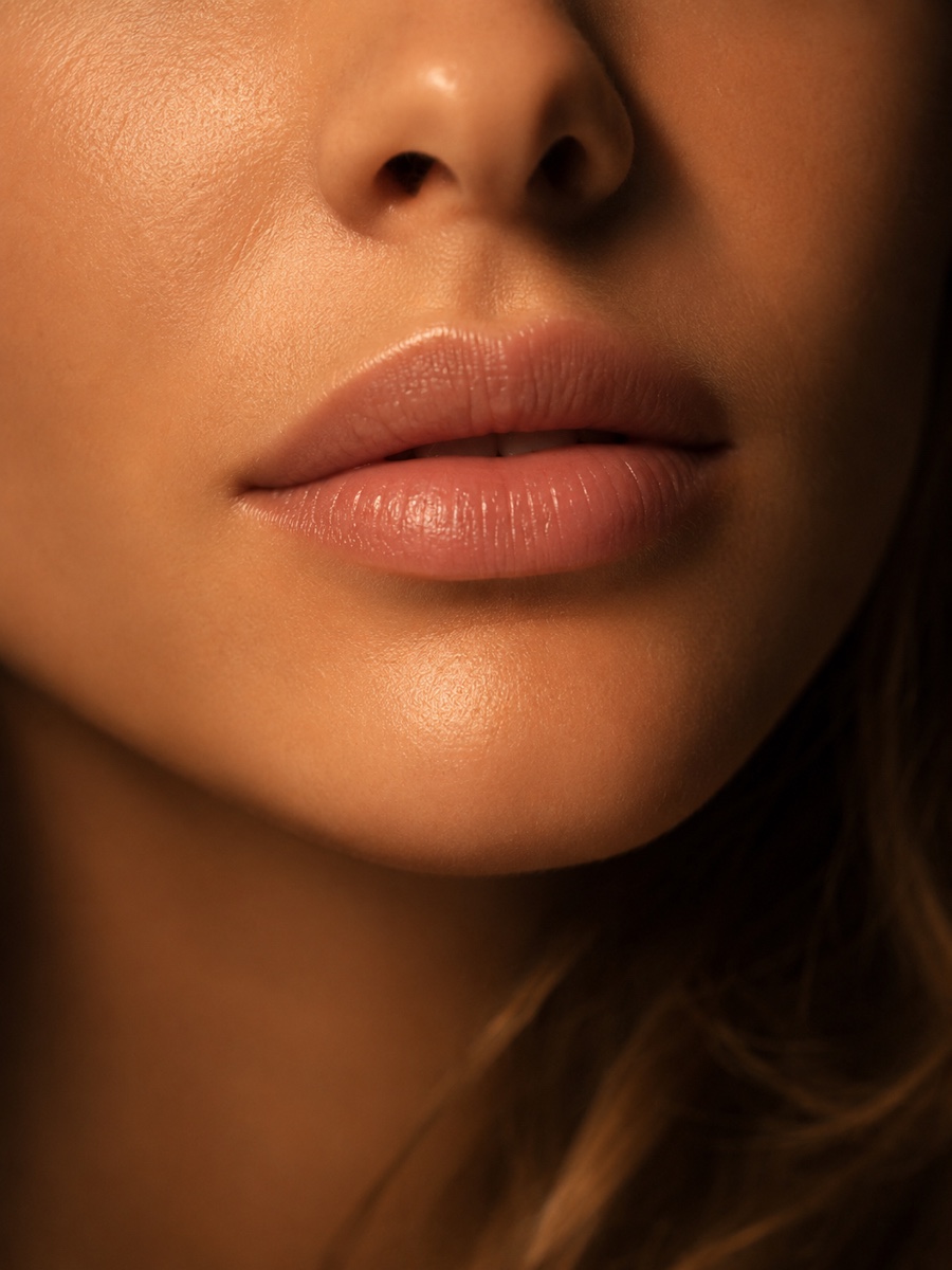 Natural full lip filler results at 2 weeks — Solace Wellness Aesthetics Fort Myers