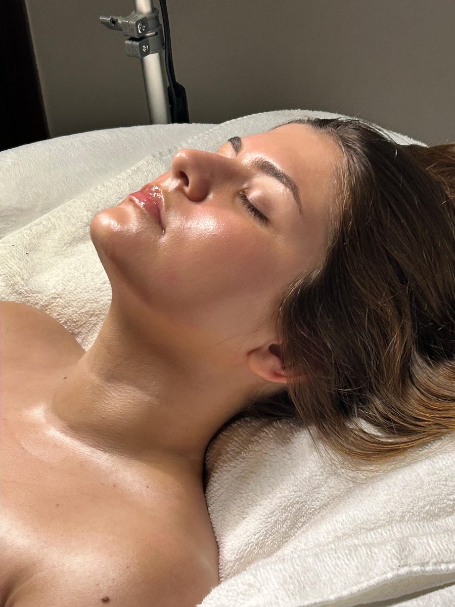 Patient after LuminFusion facial treatment at Solace Wellness Aesthetics Fort Myers FL — resurfacing, nano-infusion, and LED light therapy result